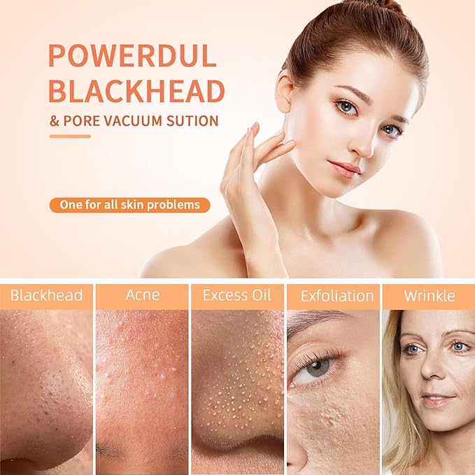 2025 Pore Vacuum, USB Rechargeable Blackhead Remover Vacuum,3 Levels Adjustable Pore Vacuum Blackhead Remover, with 5 Suction Power,6 Probes,Face Vacuum Pore Cleanser for Women & Men-Gold