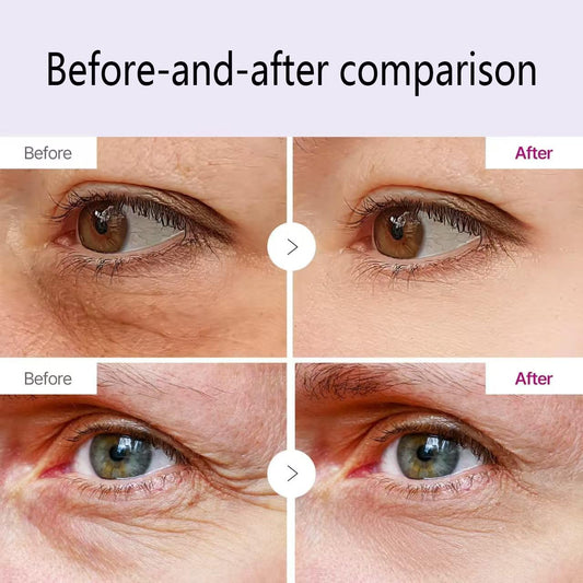 2PCS Calcium Multi Balm, cementerre calcium multi balm，Korean collagen moisturizing stick, anti wrinkle moisturizing cream for intensive repair, firming skin, suitable for eyes, neck and face