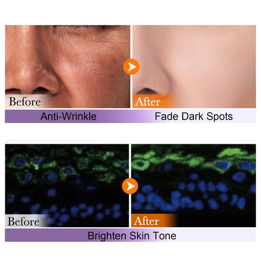 Retinol Serum for Face with Hyaluronic Acid – 1.5ml x 30PCS, Hydrating Facial Serum, Smoother Skin, Anti-Aging – Travel Size Skincare, Single-Use Vials Skincare(1.52 Fl Oz (Pack of 1))