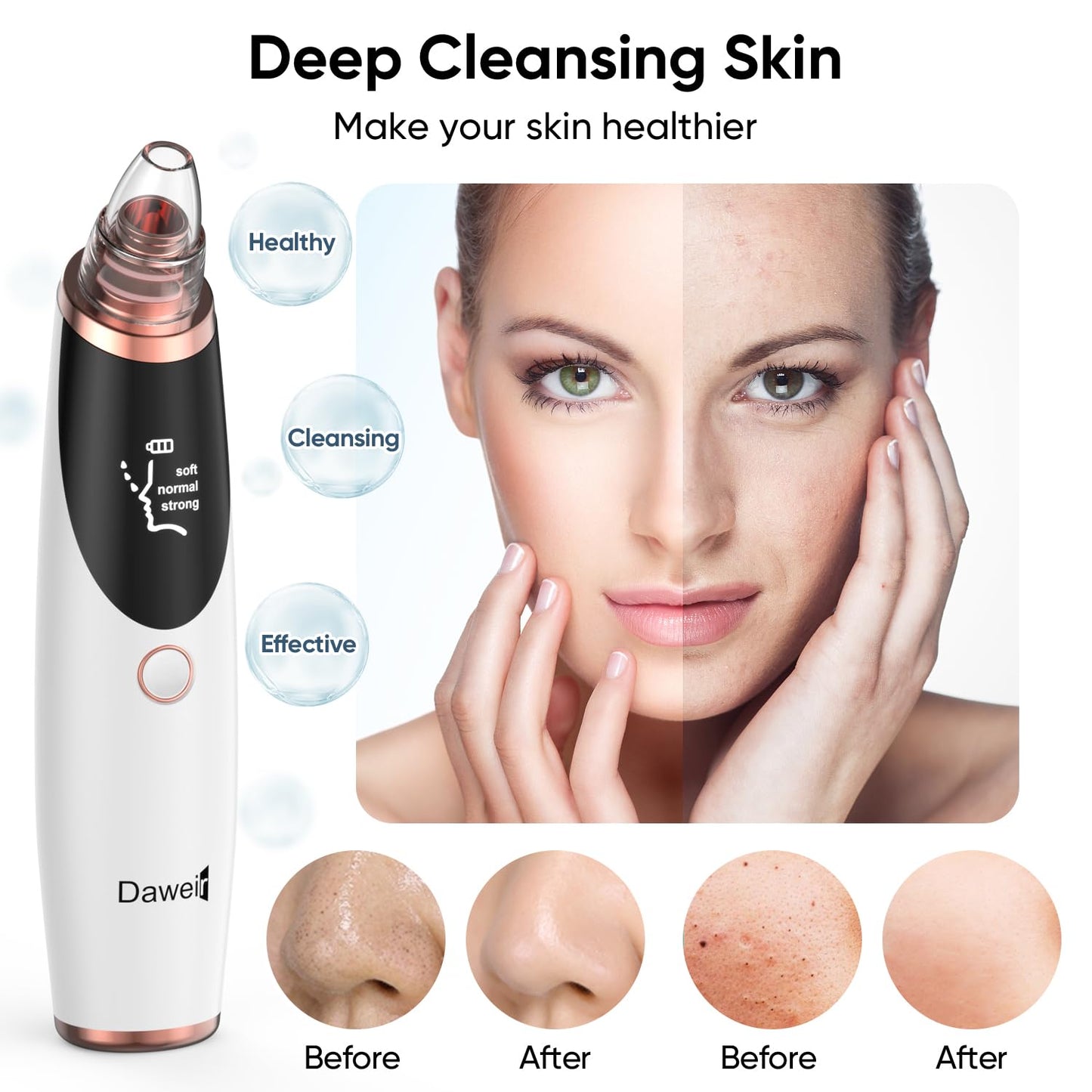 Blackhead Remover Pore Vacuum – 3 Suction Levels & 5 Probes – Facial Cleaner for Nose & Face – Rechargeable Comedone Extractor with LED Display