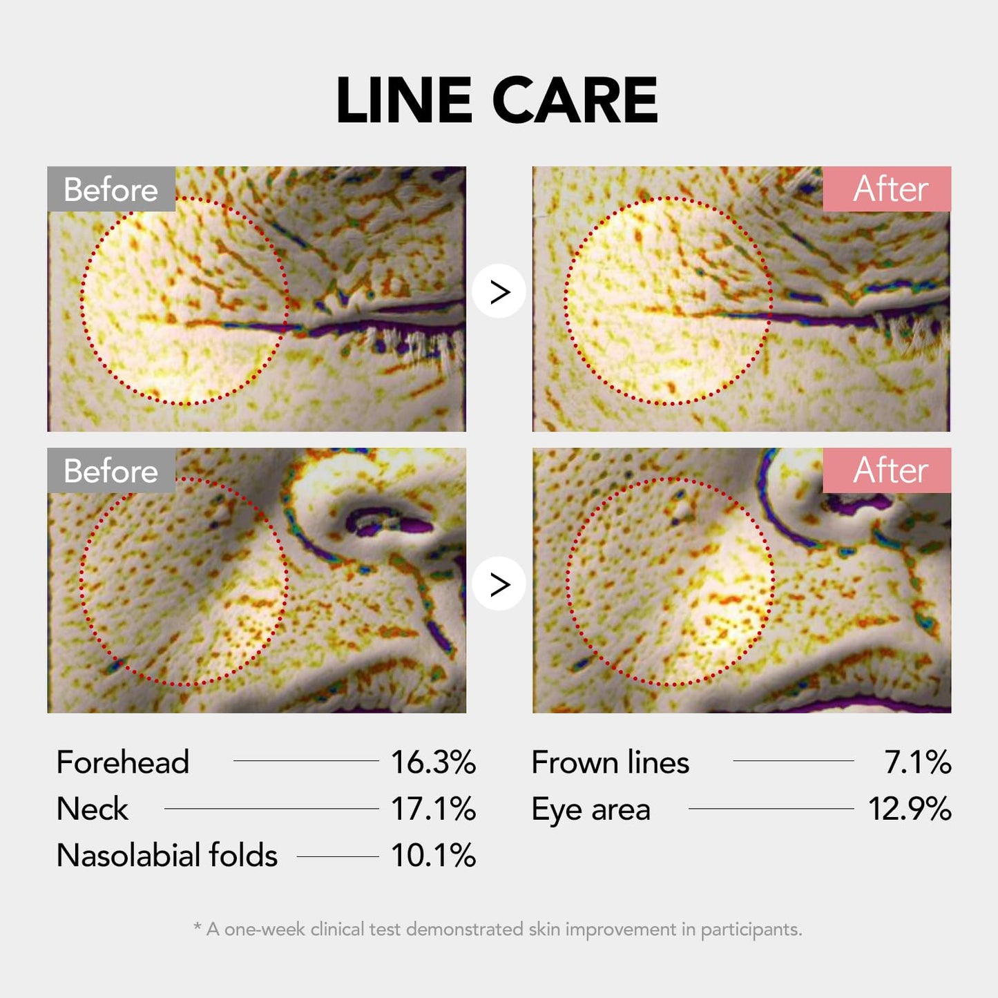 107% Crow’s Feet Improvement, 117% on Neck Lines & 109% on Nasolabial Lines – Boosts Elasticity – With Botulinum-Inspired Peptide and Collagen – Korean Skincare Korea’s Best Skincare Stick Kioskin
