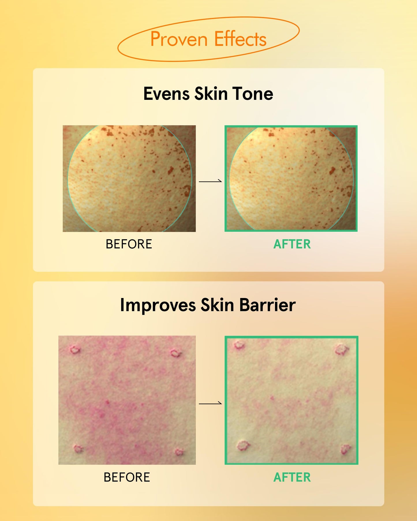 ATHE Toning Vita EGF Serum - Korean Skin Repairing Serum with Vitamin C - Hydrating & Soothing Hypoallergenic Ampoule for Day & Night Use, 1.01 fl.oz.