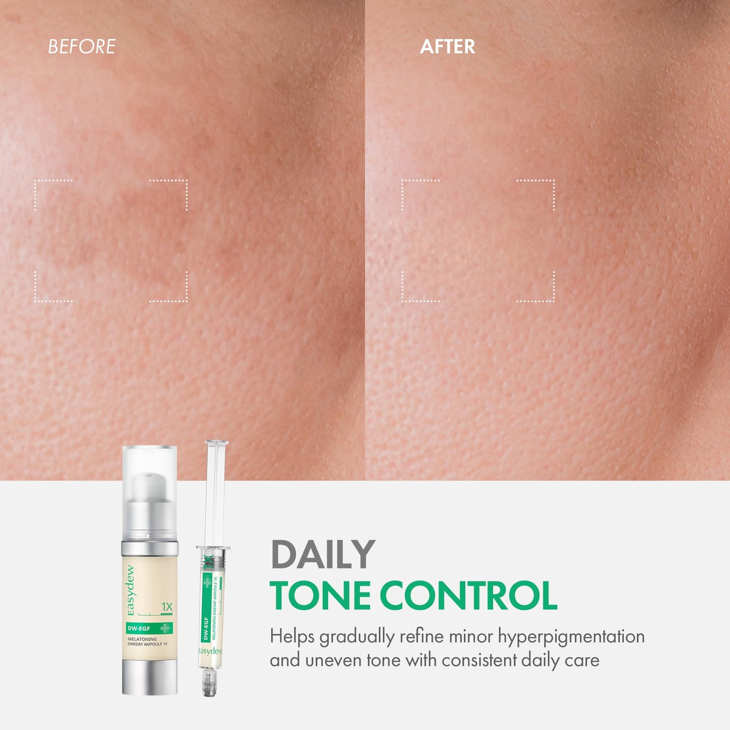 Easydew DW-EGF Melatoning Ampoule 1X - Hydrating Dark Spot Serum with Niacinamide & Glutathione for Uneven Skin - Fast Absorbing Day & Night Ampoule Korean Skin Care (Bottle 1.01 fl oz, EGF 1X)