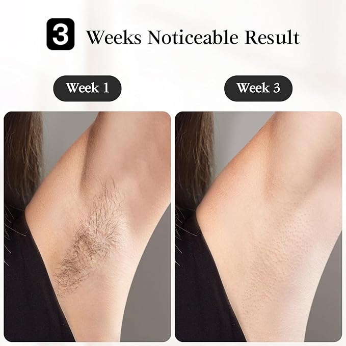 JOVS Laser Hair Removal, [24J Energy] IPL Hair Removal for Women and Men, 37°F Painless Sapphire Ice-Cooling Tech, 6 Modes for Whole Body Hair Removal Device, 2 in 1 Skin Rejuvenation, 330° Rotation