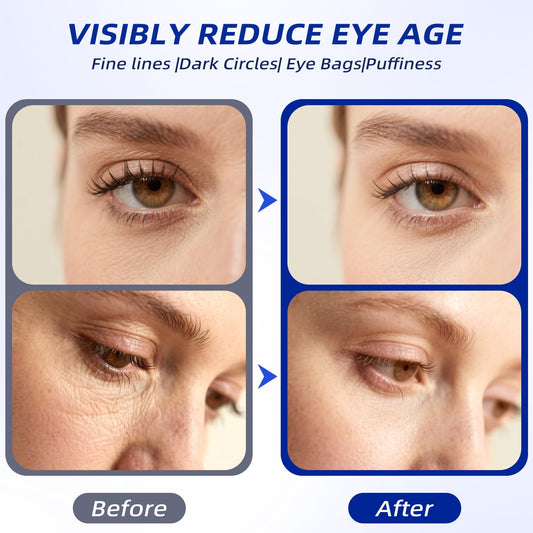 Relaso Eye Cream for Wrinkles & Crows Feet - with Essential Ceramides, Peptides & Caffeine & Niacinamide - Reduce Puffiness & Bags Under Eyes, Under Eye Cream for Women & Men, 0.5 Oz