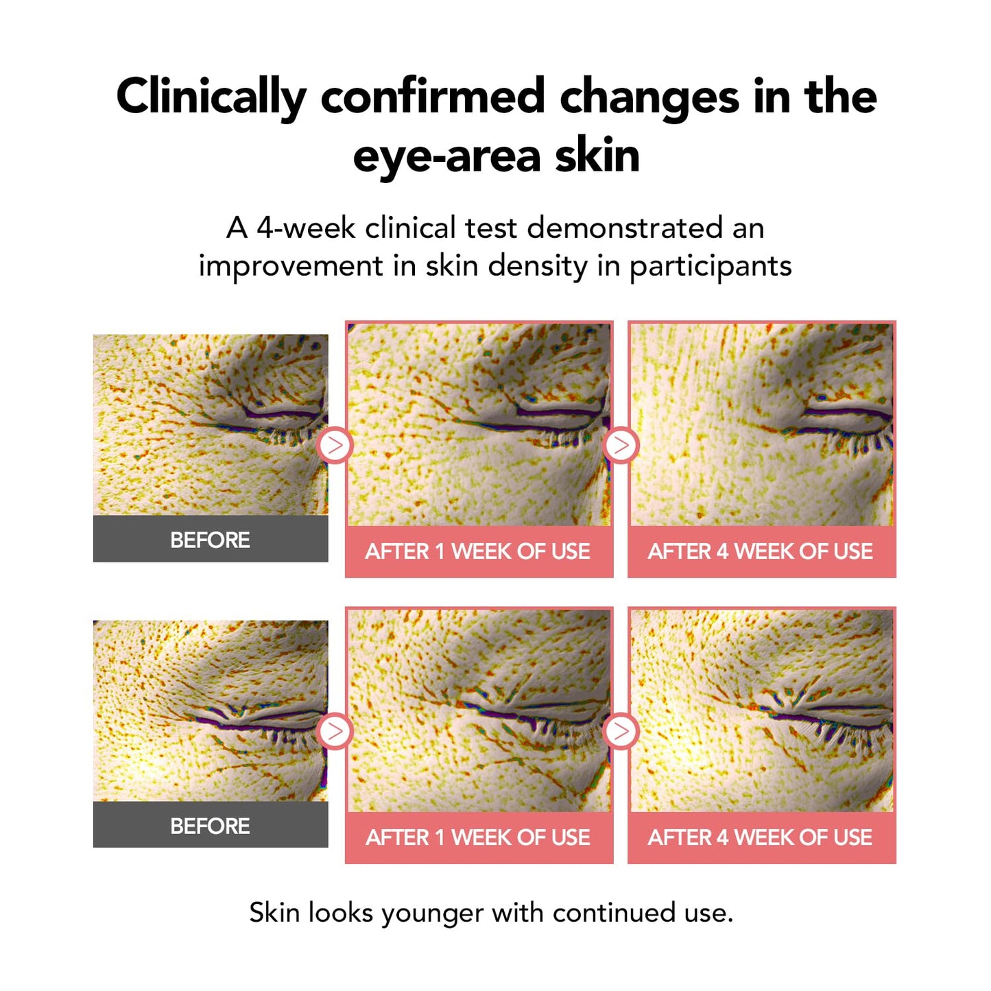 KIOSKIN 107% Smoother Crow’s Feet & 104% Lifted Skin – Boosts Elasticity & Moisture – Firms & Restores Radiance with 10% Collagen Water & Hyaluronic Acid – Korean Skincare Best Collagen Cream