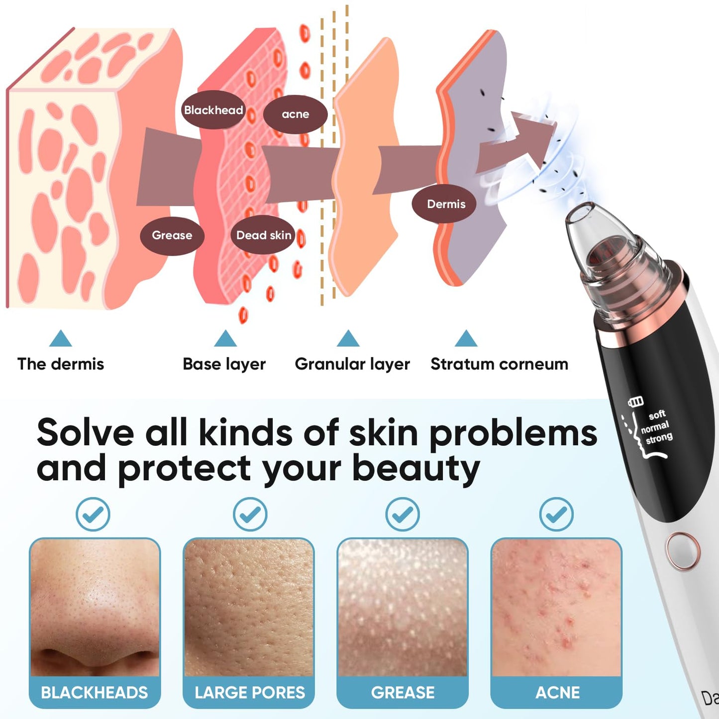 Blackhead Remover Pore Vacuum for Face & Nose – Deep Cleansing Blackhead Remover Tools with 3 Suction Levels, 5 Replaceable Tips, USB Rechargeable Pore Cleaner