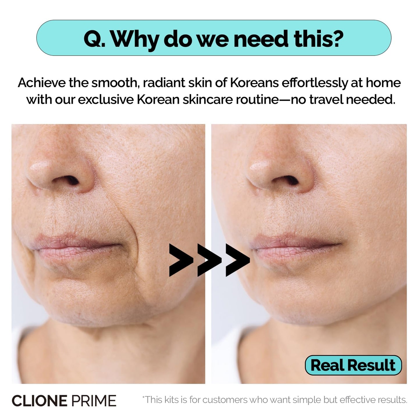 CLIONE PRIME KBeauty Skin Clinic at Home - 4 Step Night Care Kit - Anti-Aging Lifting & Firming Treatment for Wrinkles, Elasticity & Hydration - Korean Skincare Essence, Mask, Booster & Ampoule Set