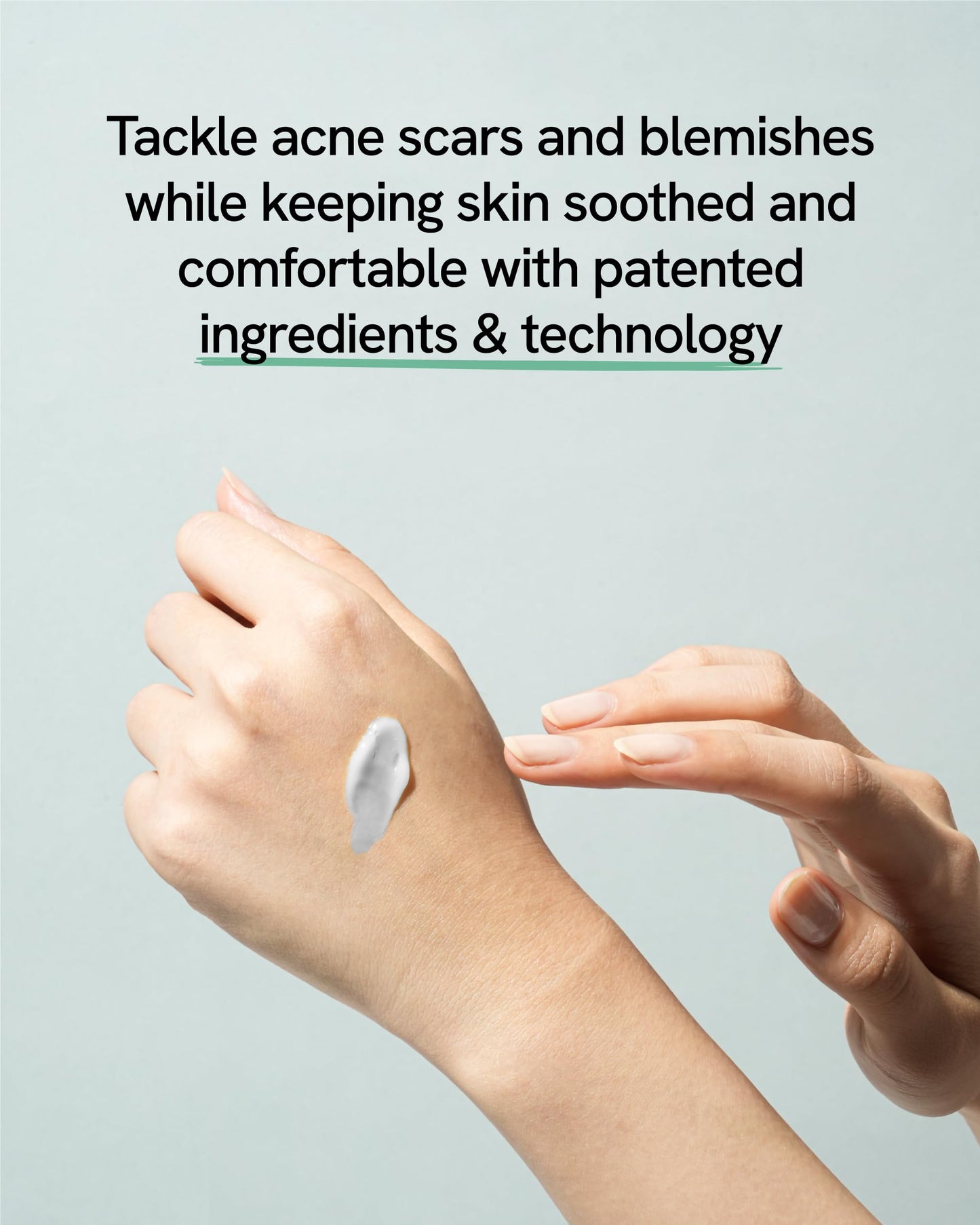 Bye od-td Blemish Treatment (0.7fl oz) - Post-Blemish Marks, Correction Korean Skin Care. TECA, Allantoin, Herb-Vinegar Tincture.