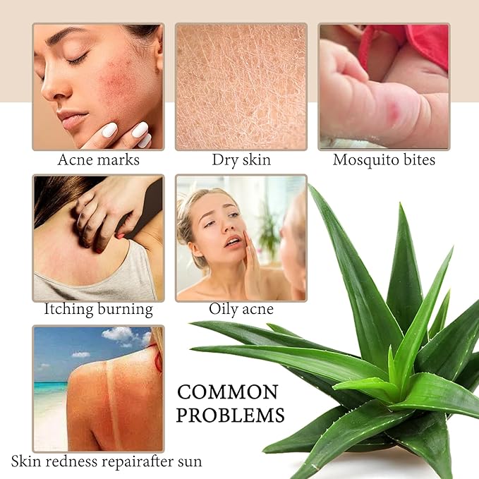 16PCS Soothing Aloe Vera Gel for Face,Organic Aloe Vera Gel,Hydrating After Sun Lotion Set,Non-Sticky Moisturizing After Sun Lotion for All Skin Types, 1.05 Oz