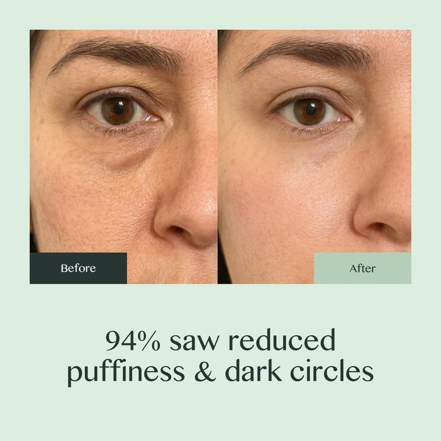 OURAGLOW Caffeine Eye Cream for Dark Circles and Puffiness – Moonstone Under Eye Cream with Cooling Tip, Retinol, Hyaluronic Acid & Peptides – for Wrinkles, Bags, Fine Lines – Fragrance-Free