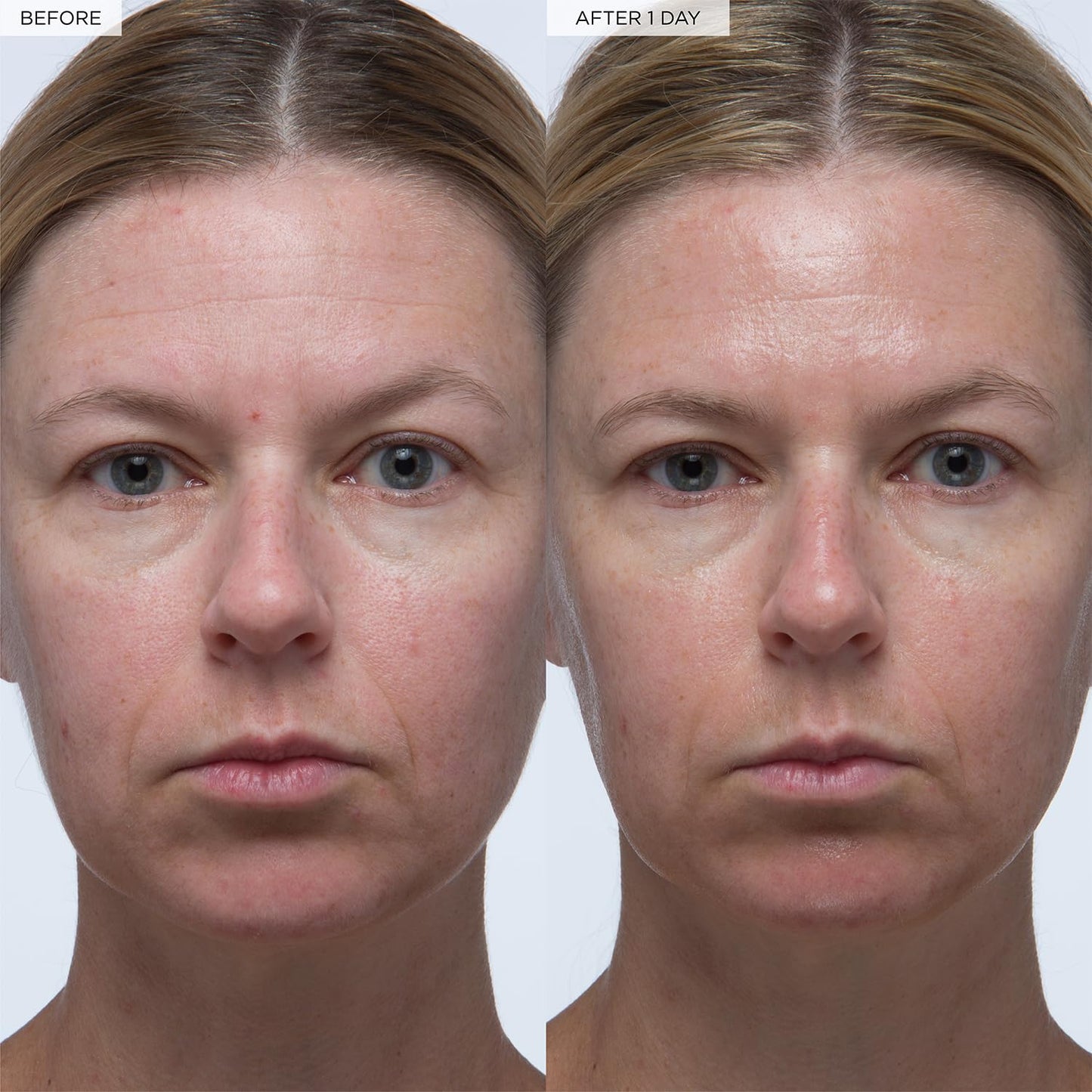 Glow Recipe Plum Plumping & Hydrating Hyaluronic Acid Korean Skin Care Serum - Antioxidant Anti Aging Face Serum + Vitamin B5 for Lasting Skin Barrier Repair & Firming Lines & Wrinkles - Vegan, 30ml