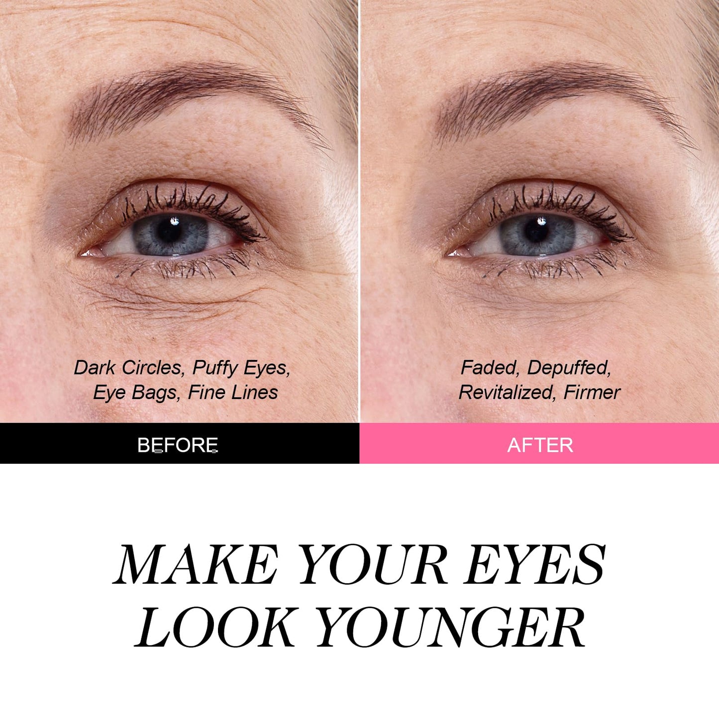 ZealSea Under Eye Patches for Puffy Eyes and Dark Circles, Collagen Under Eye Mask for Dark Circles and Puffiness, Travel Essentials, Eye Gel Pads for Spa Party, Self Care Gifts for Women, 20 Pairs