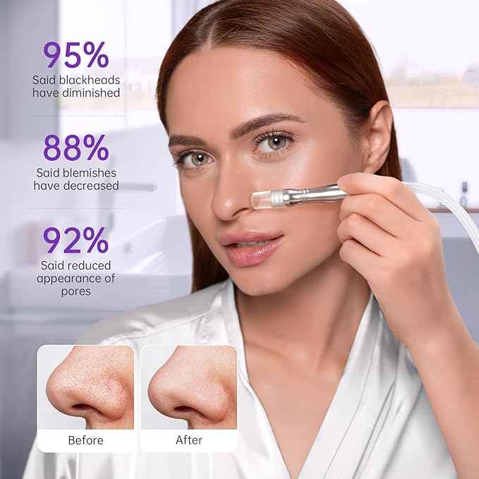 Blackhead Vacuum Removers, 2 in 1 Pro-Grade at-Home Spa Facial Vacuum Pore Cleaner for Blackheads, Whiteheads, Exfoliation, 20-80 Kpa Adjustable Suction for All Skin Types, White