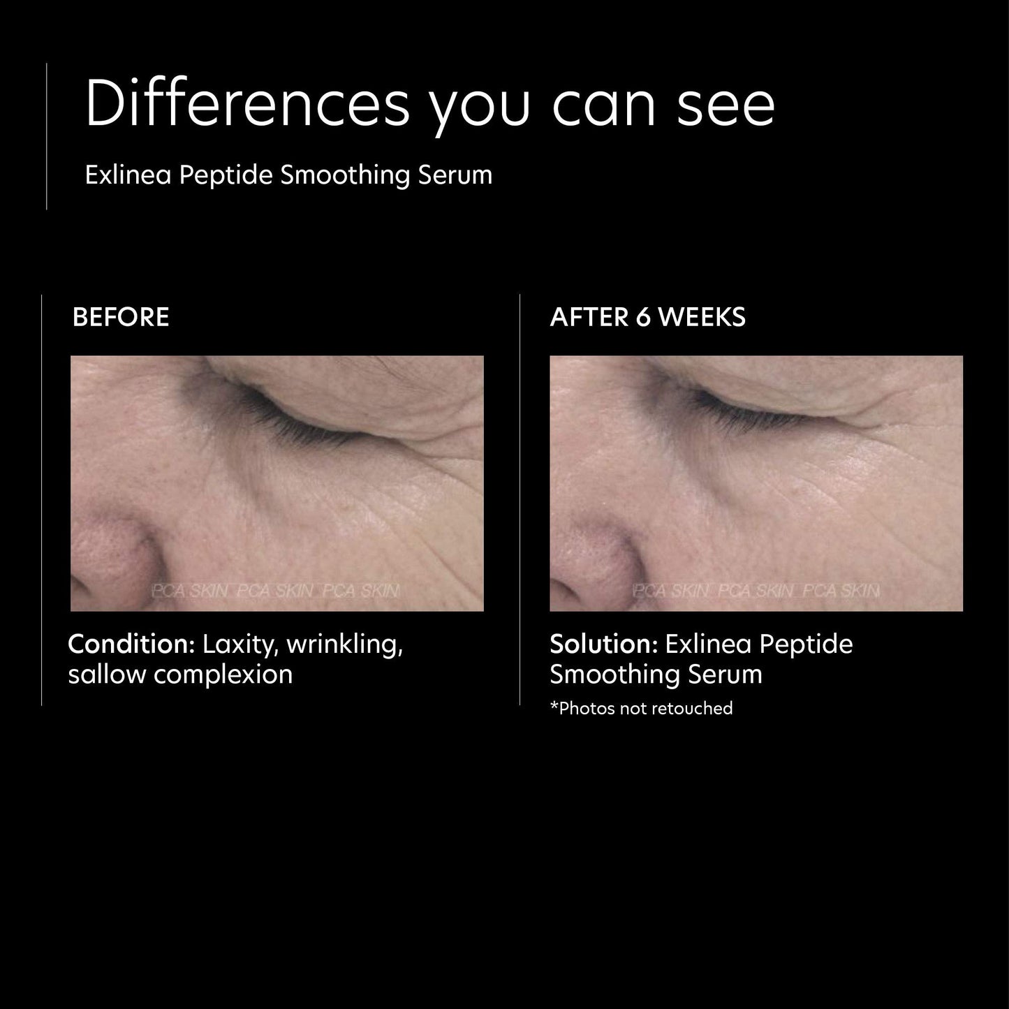 PCA SKIN Vitamin C&E Advanced Brightening Treatment & Hyaluronic Acid Boosting Serum Bundle - Anti Aging Treatment for Dark Spots, Discoloration, Skin Damage, Fine Lines & Wrinkles