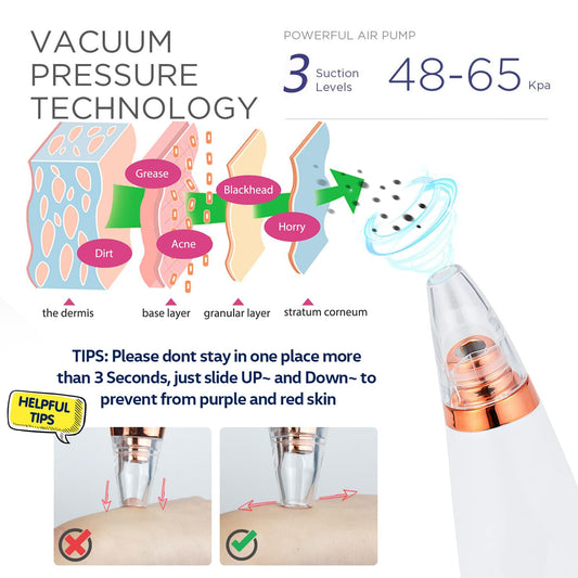 2025 Blackhead Remover Vacuum, Black Head Remover for Face, Blackhead Extractor with 3 Suction Power, 6 Suction Probes, 4 pcs Pimple Popper Tool Kit, USB Interface Type Pore Vacuum