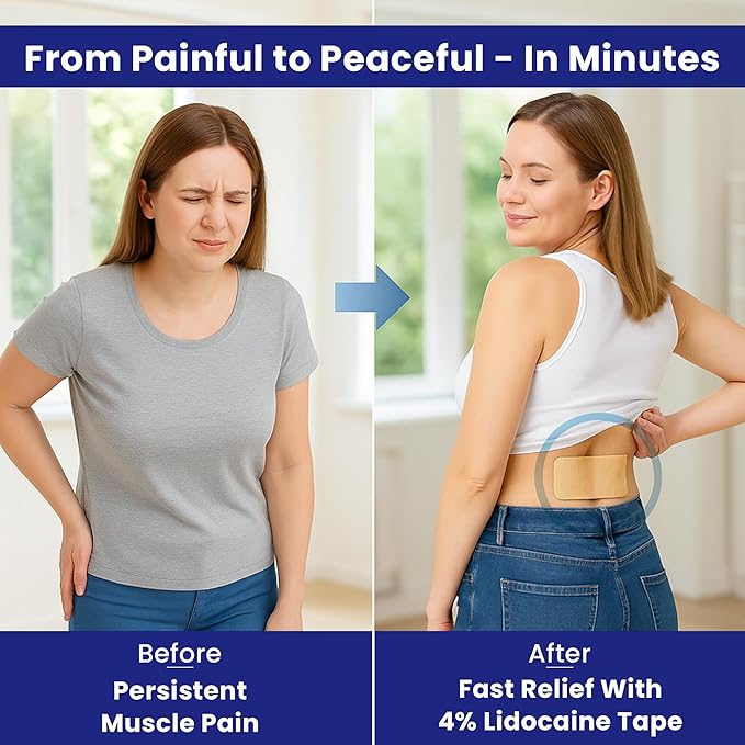 4% Lidocaine Maximum Strength Pain Relief Kinesiology Tape - Relieves Back, Joints and Muscle Pains - Superior Sticking, Aluminum-Free Water Resistant, and USA Made - 2" x 10" Strips