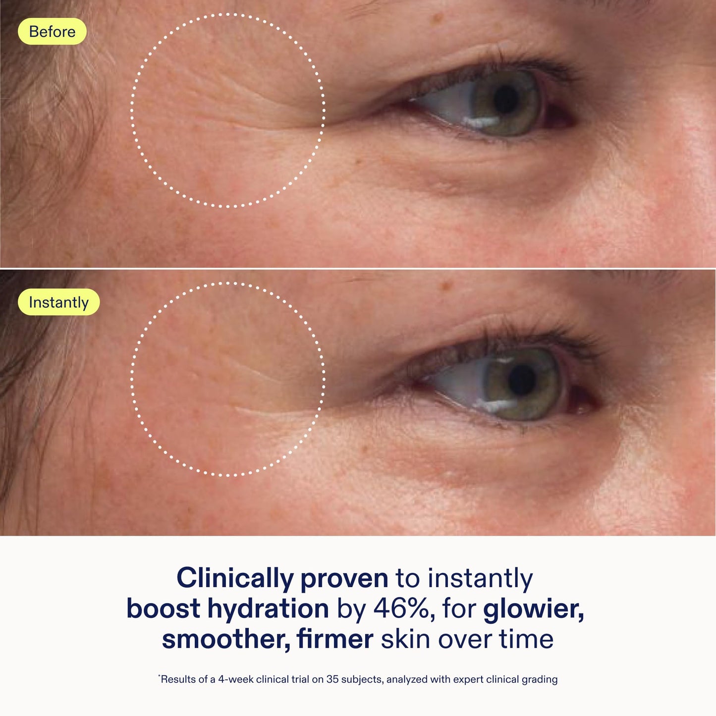 Skinfix Triple Lipid-Peptide Cream Mini - 0.5 oz - Rich Face Moisturizer to Instantly Hydrate & Restore Dry, Sensitive Skin - Non-Comedogenic, Fragrance Free, Vegan, Cruelty Free