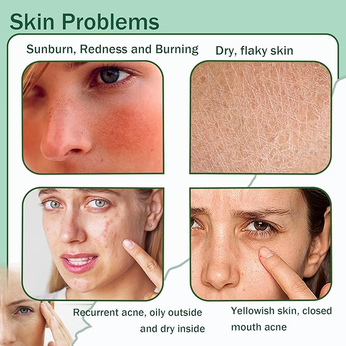 8PCS Purity Aloe Vera Gel - Hydrating Aloe Vera Gel for Face and Skin,No Sticky Moisturizing Aloe Gel L