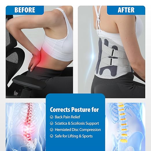 Back Brace for Men Lower Back Pain Relief, Lumbar Support Belt with Breathable Pad, Adjustable Back Support Brace for Women & Men - Scoliosis, Sciatica & Herniated Disc Relief(Small)