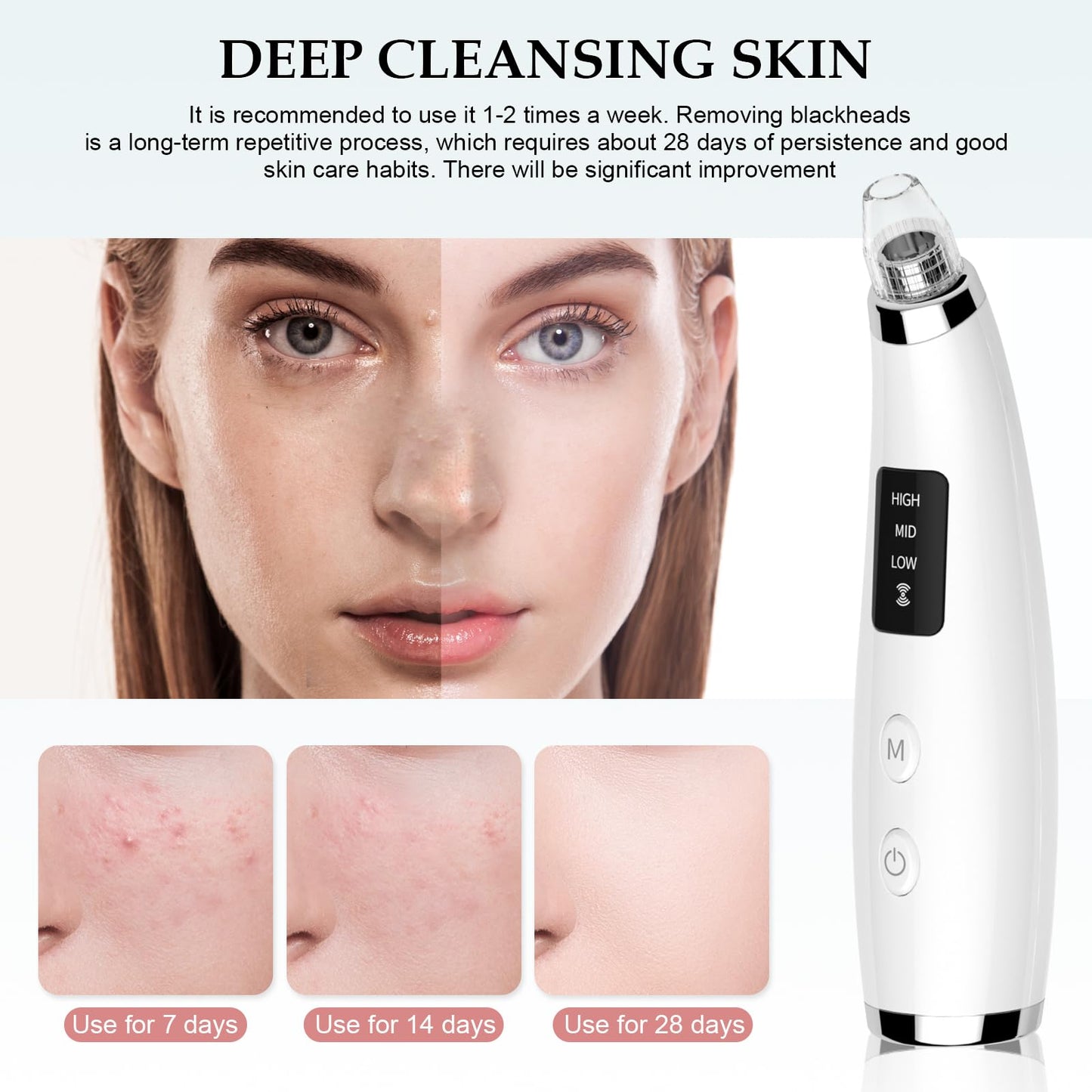 Blackhead Vacuum Removers - Pore Vacuum for Face with 5 Attachments & 3 Suction Levels - USB Rechargeable Blackhead Remover Tools for Women and Men (White)