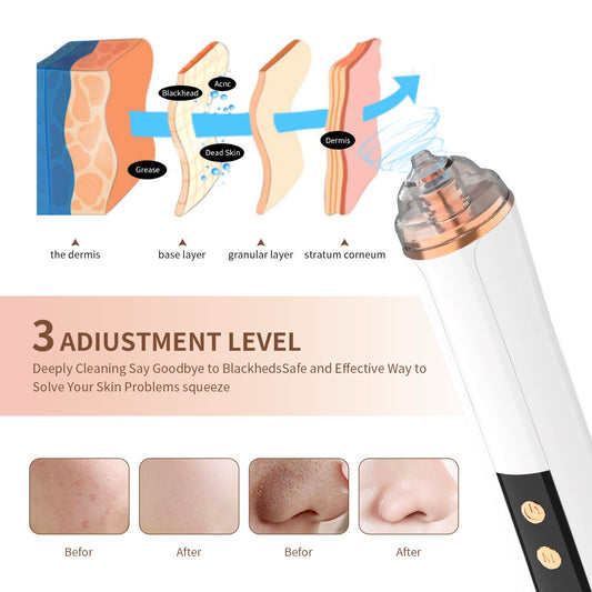 Blackhead Remover Pore Vacuum,Facial Pore Cleaner-6 Suction Power,3 Adjustable Suction Levels,USB Rechargeable Blackhead Vacuum Kit Electric Acne Extractor Tool for Women & Men (Off White)