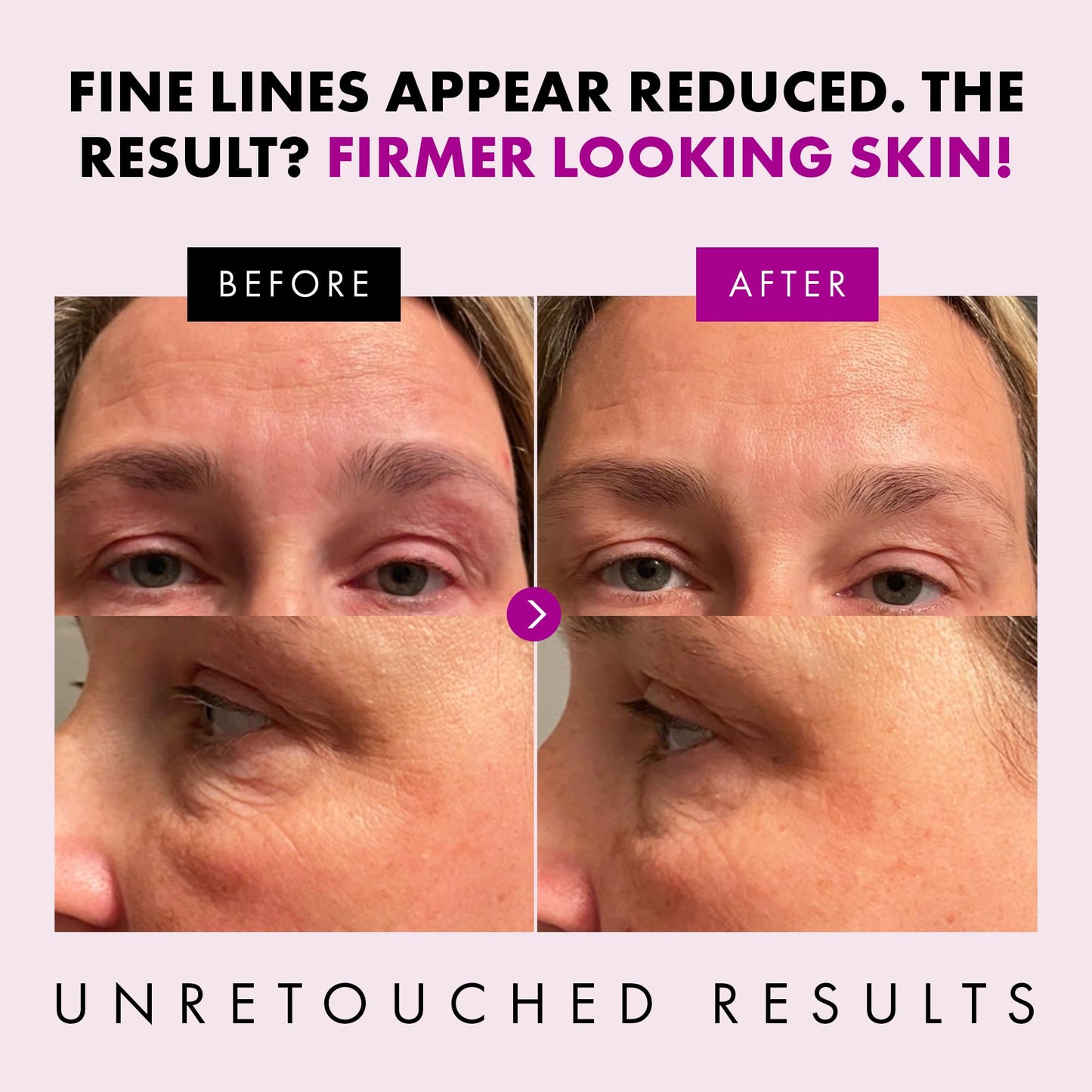 Collagen Anti Aging Face Cream with Patented Matrixyl-3000 & Argireline - 5x More Powerful w/ Pep-Boost Peptide Complex + 10 Antioxidants - Facial Wrinkle Day/Night Cream Face Moisturizer for Women