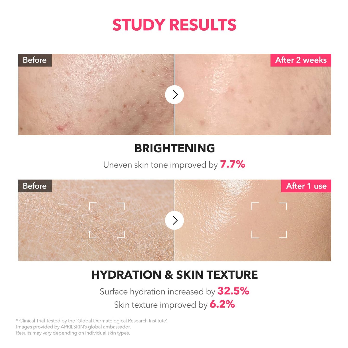 APRILSKIN TXA+Niacinamide 99 Pink Milky Toner | 99% High-Purity TXA 3%+ Niacinamide 5% for Brightening | Highly Concentrated Cream Toner | Deep Moisturizing Formula for Dull Skin | 5.07 fl.oz.