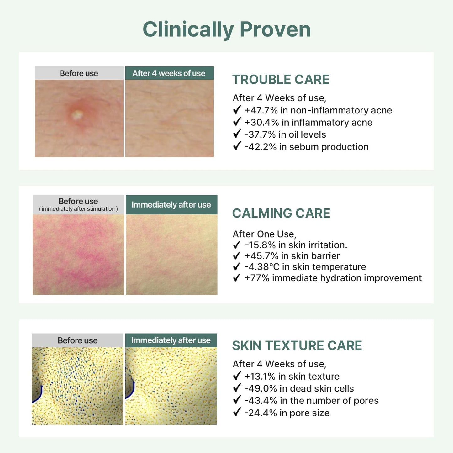 AROCELL OFFICIAL Cica Repair Hydrogel Mask – Korean Skincare Gel Face Mask with Centella Asiatica, Exosomes, Collagen & Niacinamide – Hydrating Face Masks for Redness, Acne & Glass Skin – 7 Sheets