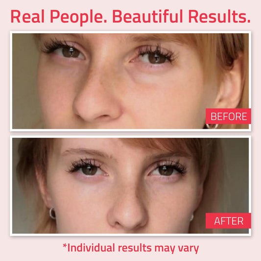 YEOUTH Retinol Eye Cream Anti Aging, Firming Under Eye Cream for Puffiness and Bags Under Eyes for Wrinkles and Dark Circles with Hyaluronic Acid and Tripeptides 15ml