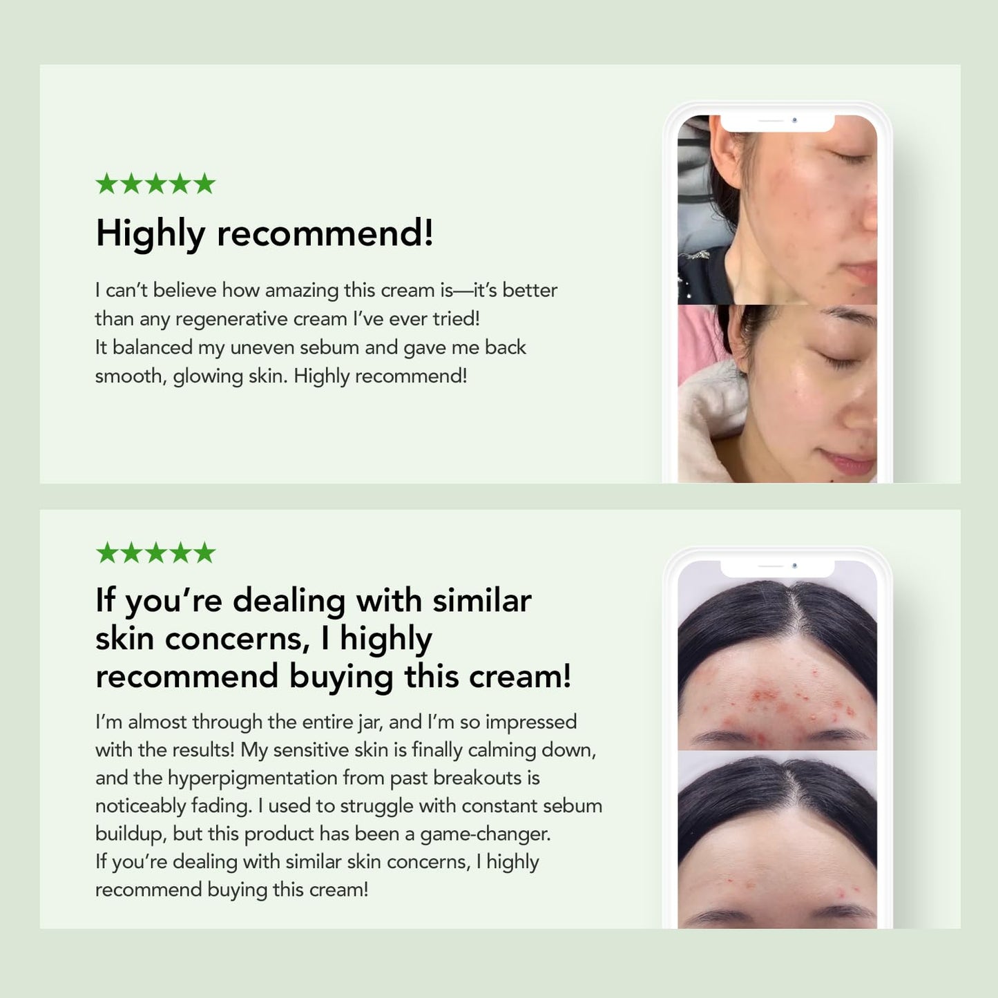 KIOSKIN 31% Reduction in Sebum & 15.5% High-Dose D-Panthenol – Calms Redness, Repairs Skin Barrier & Locks in Hydration – With Heartleaf Extract & Hyaluronic Acid – Korean Skincare Top Barrier Cream