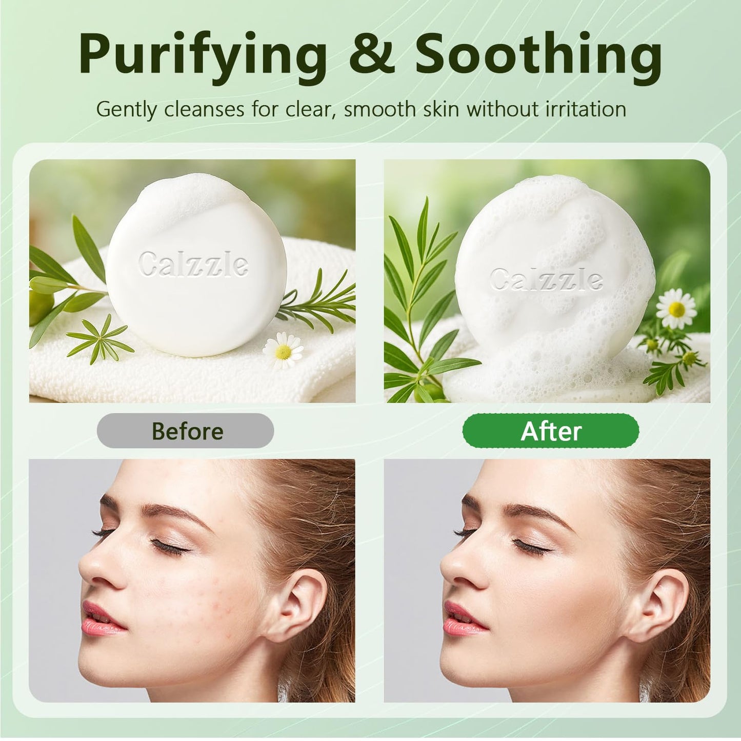 Calzzle 4 Pcs Herbal Soap Bar with Tea Tree Oil, Olive Oil & Organic Shea Butter - Natural Handmade Soap for Women & Men, Gentle Face, Body & Foot Cleanser for Dry, Itchy or Sensitive Skin, 3.53 oz