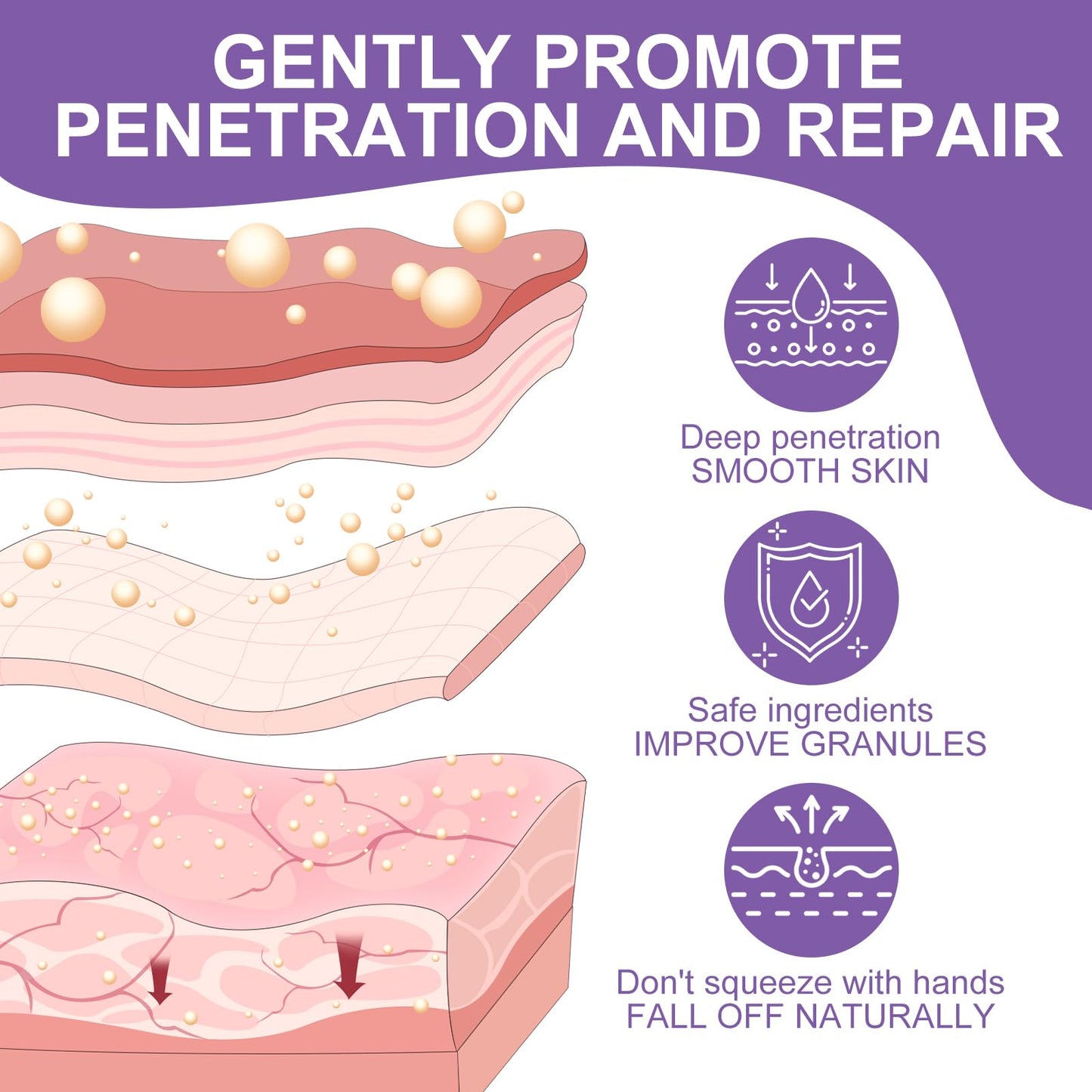 Milia Remover Cream for Eyes and Face,Milia Spot Remover with Salicylic Acid,Milia Acne Cream(1 Fl Oz (Pack of 1))