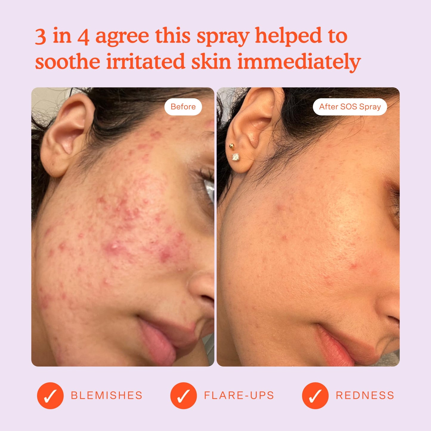 Tower 28 SOS Daily Rescue Facial Spray 1 FL OZ & Tower 28 SOS Cleanser 150 ML