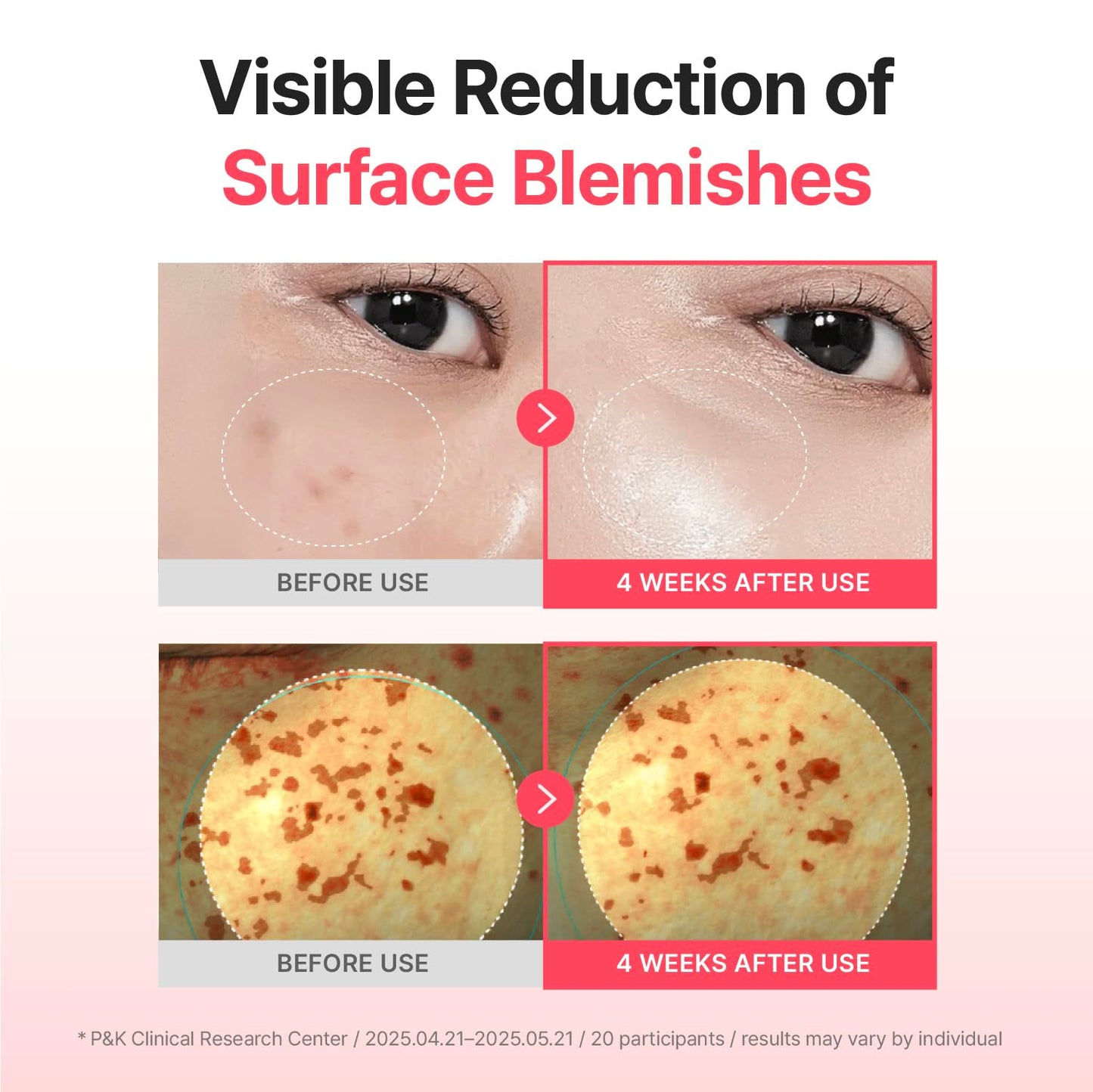 CENTELLIAN 24 Madeca Mela Capture Ampoule Capsule Cream | Brightening & Anti-Aging Face Moisturizer with Peptides & Centella Asiatica, Hydrating & Firming Korean Skincare Cream, 1.85 fl oz (55ml)