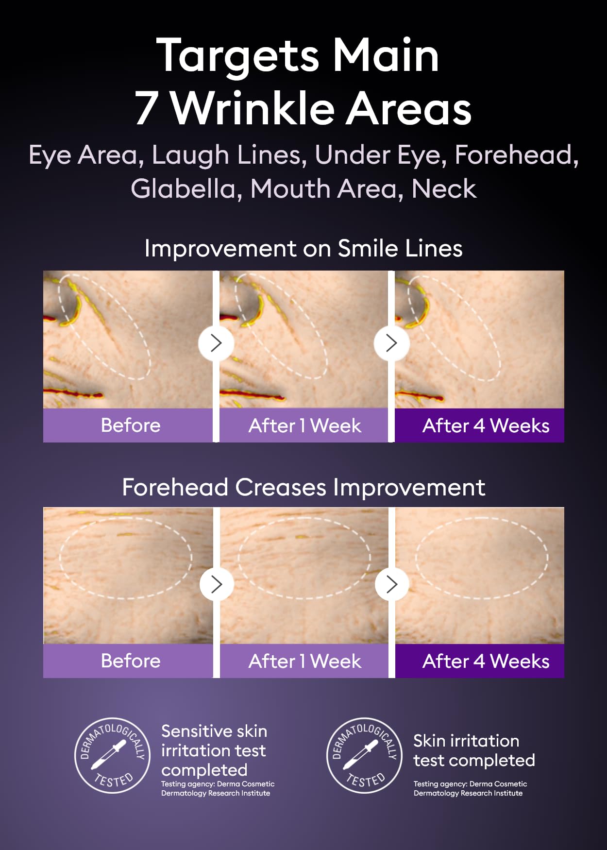 MISSHA Time Revolution Night Repair Retinol Intensive Ampoule 0.33 Fl oz - Advanced Korean Facial Serum for Skin Barrier Strengthening, Improved Elasticity, Radiance, Overnight Moisturization