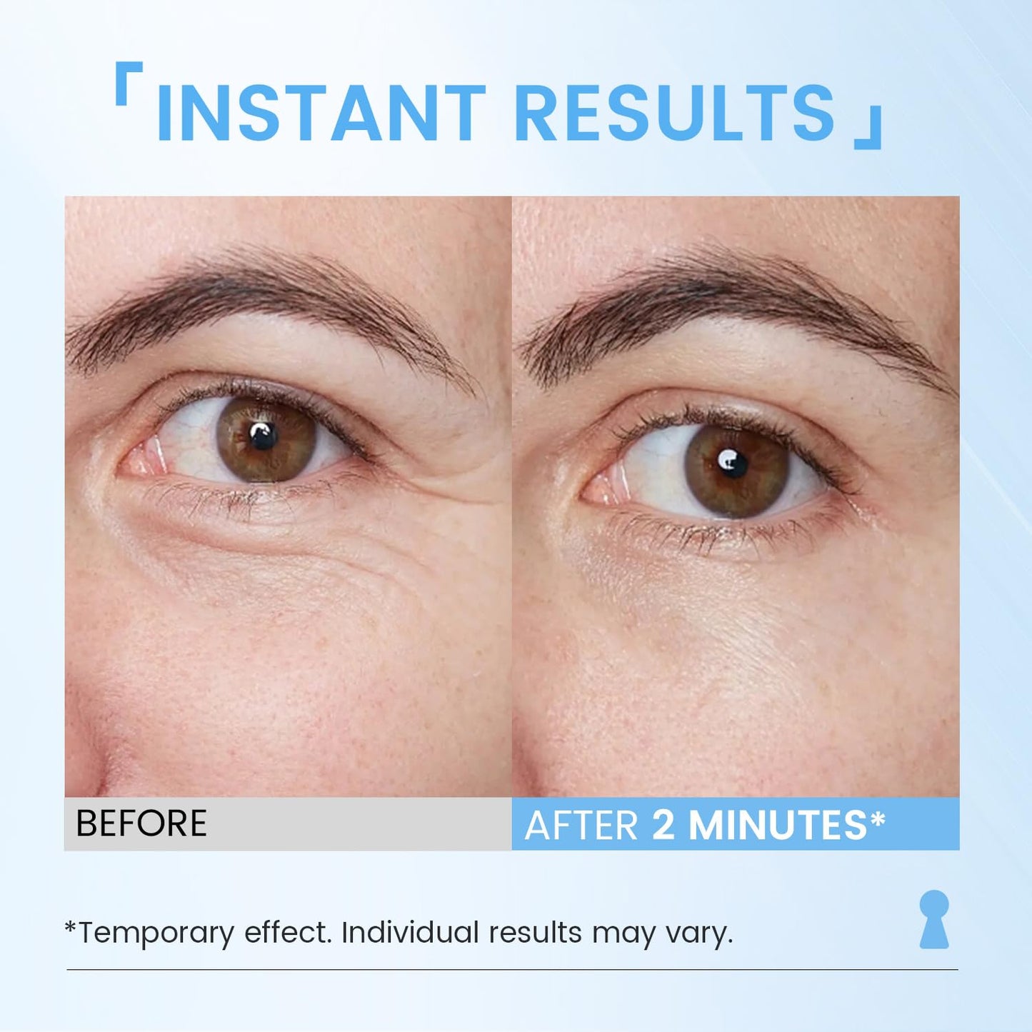 RONKIE Instant Eye Lift Cream: Reduces Eye Bags Wrinkles Puffy Eyes Dark Circles Crow’s Feet in Minutes for Mature Skin of Middle-aged Women 1 Fl Oz