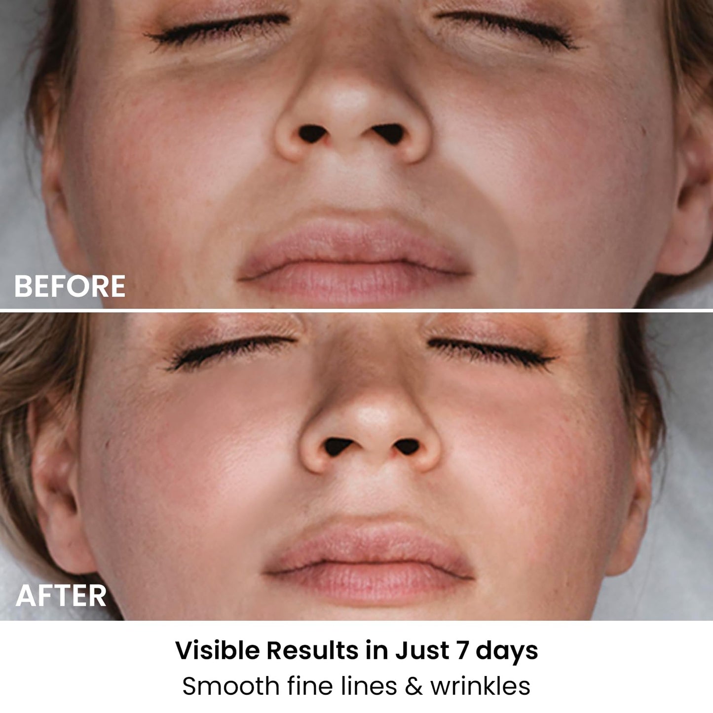 AMIRO Spectra 5-in-1 Light Therapy Face Mask, Contour With Blue, Red, Green, Yellow, and Infrared Light, 3 Modes for Oily, Acne-Prone, and Sagging Skin, Skincare for Face, Silver