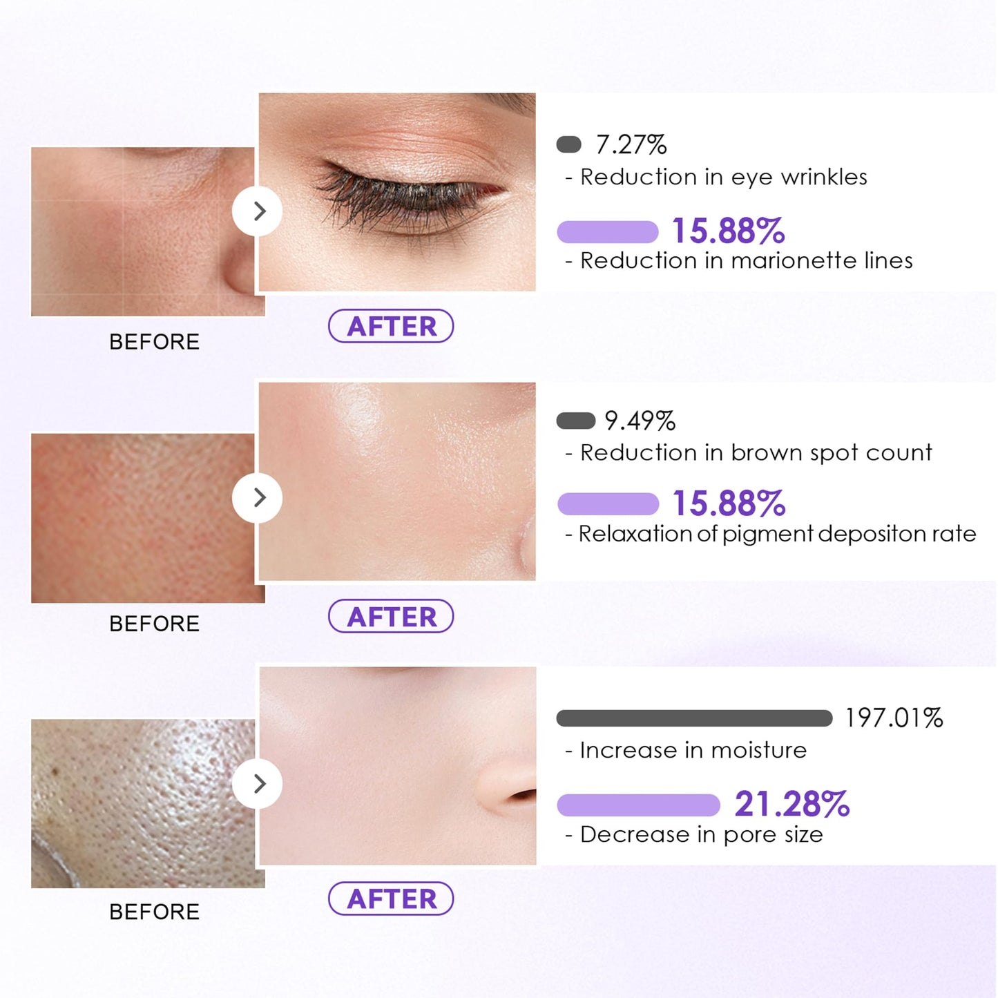 YUOLITA Deep Collagen Jelly Gel Face Mask,Bio-Collagen Facial Mask for Glass Glow Skin,Hydrating Hydrogel sheet Overnight Mask, low molecular weight collagen for lifting, firming, and moisturizing