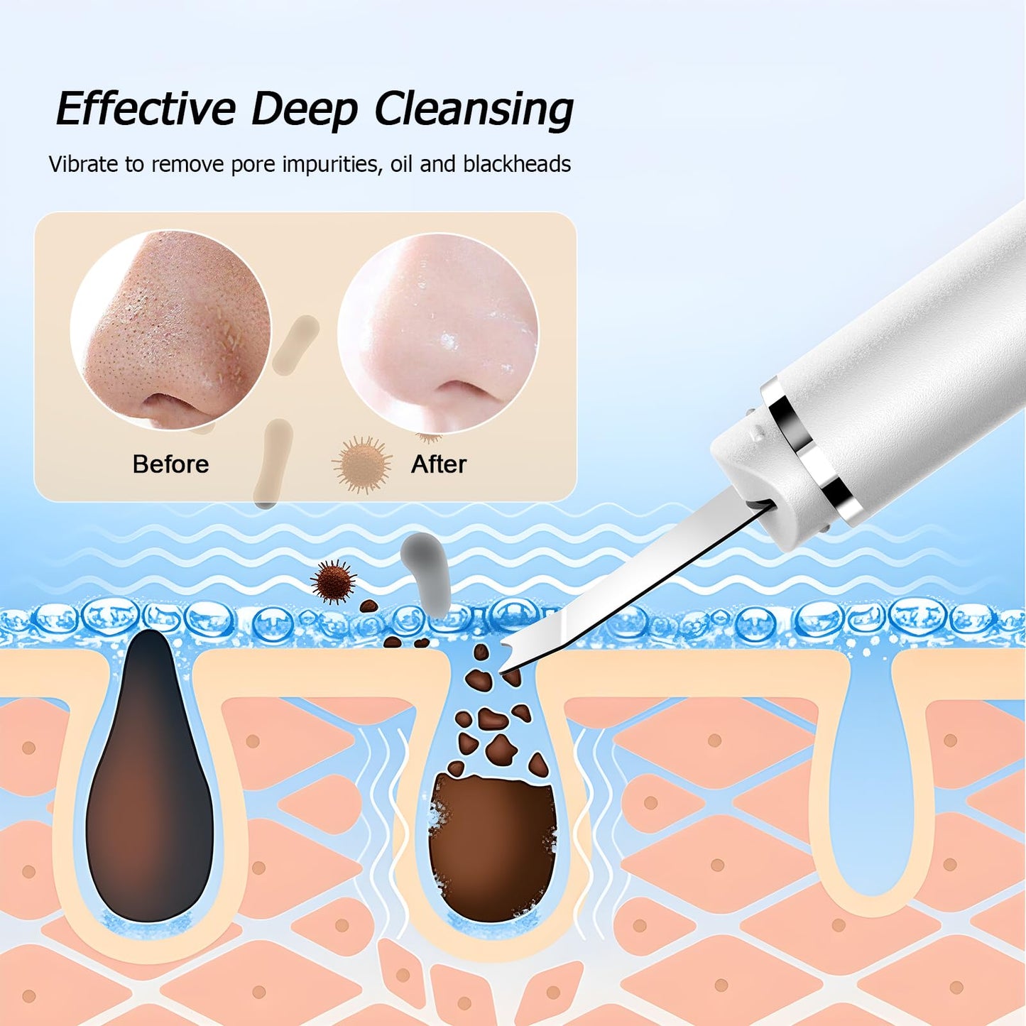 AIWOIT Face Scrubber Skin Spatula, Black Head Remover for Face and Nose, Pore Cleaner Blackhead Remover Tools, Deep Cleansing Facial Whitehead Removal Extractor, Skin Care Gifts for Women