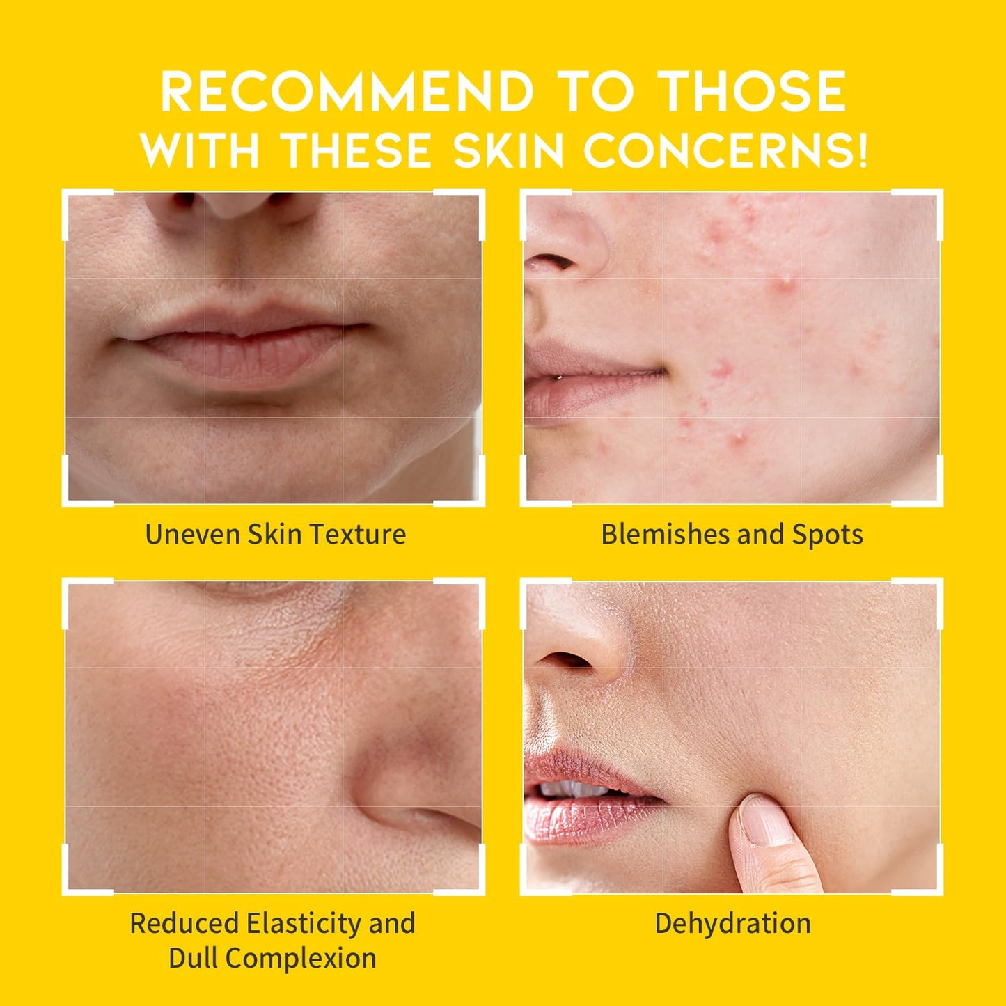 Boosting Toner Pads for Face Oily Skin Korean, #OOTD Vitamin C Niacinamide Heartleaf Hydrating Calming Redness, Vitamin C Toner Pad 70Pads 4.05oz 120ml