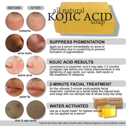 SKINLYTE Kojic Acid Soap Natural -Fragrance Free and Dye Free- Dark Spot Remover Hyperpigmentation Corrector K-Beauty Formula - Turmeric, Glycerin, Collagen, Hyaluronic Acid, Retinol (2 Pack) 7oz.