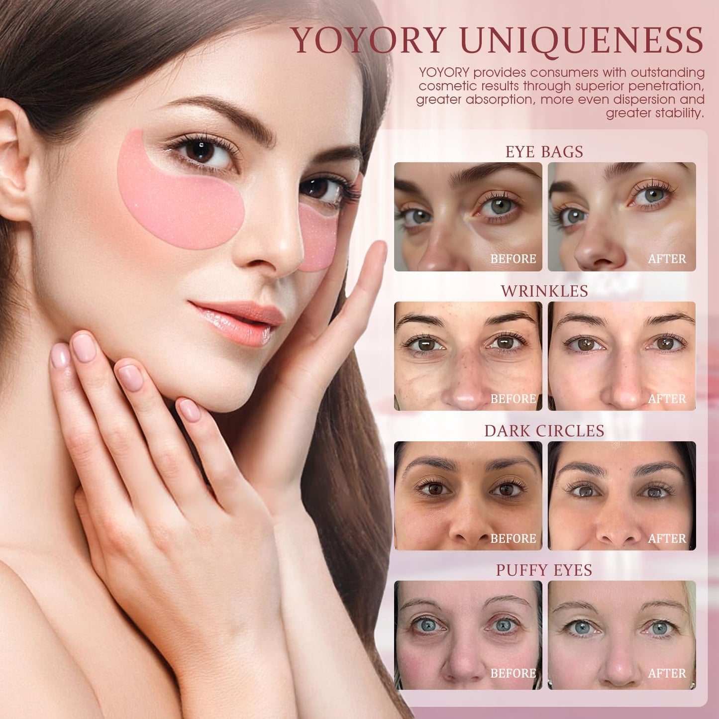 YOYORY Under Eye Patches Masks - for Dark Circles, Puffiness, Eye bags,and Fine Lines Smoothing Skin Care Treatment with Collagen and Hyaluronic Acid for Women and Men, (60 Pcs) Pink