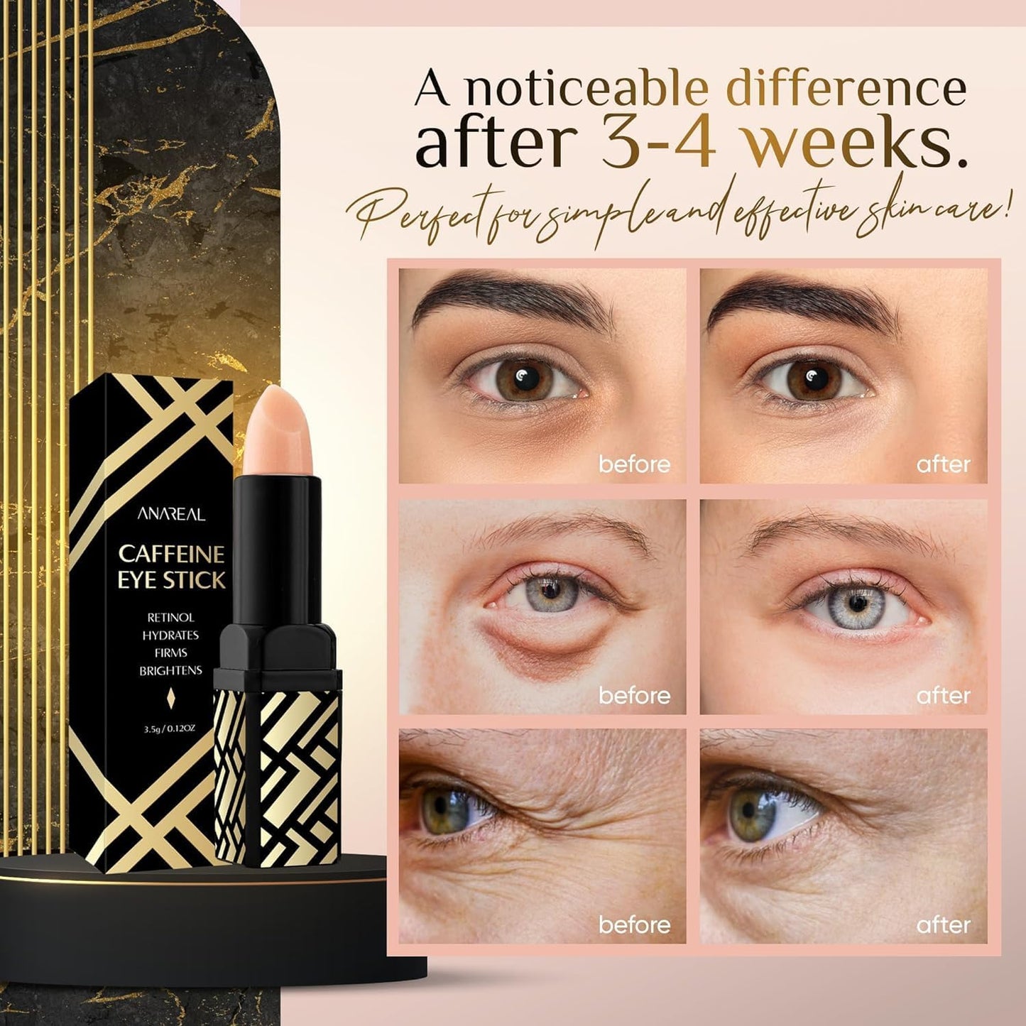 Caffeine Under Eye Balm: Hydrating Eye Brightener Stick Cream for Dark Circles & Puffiness, Anti-Wrinkle Korean Skincare Treatment with Retinol, Instant Cooling Glow for Eyes, Face & Bags