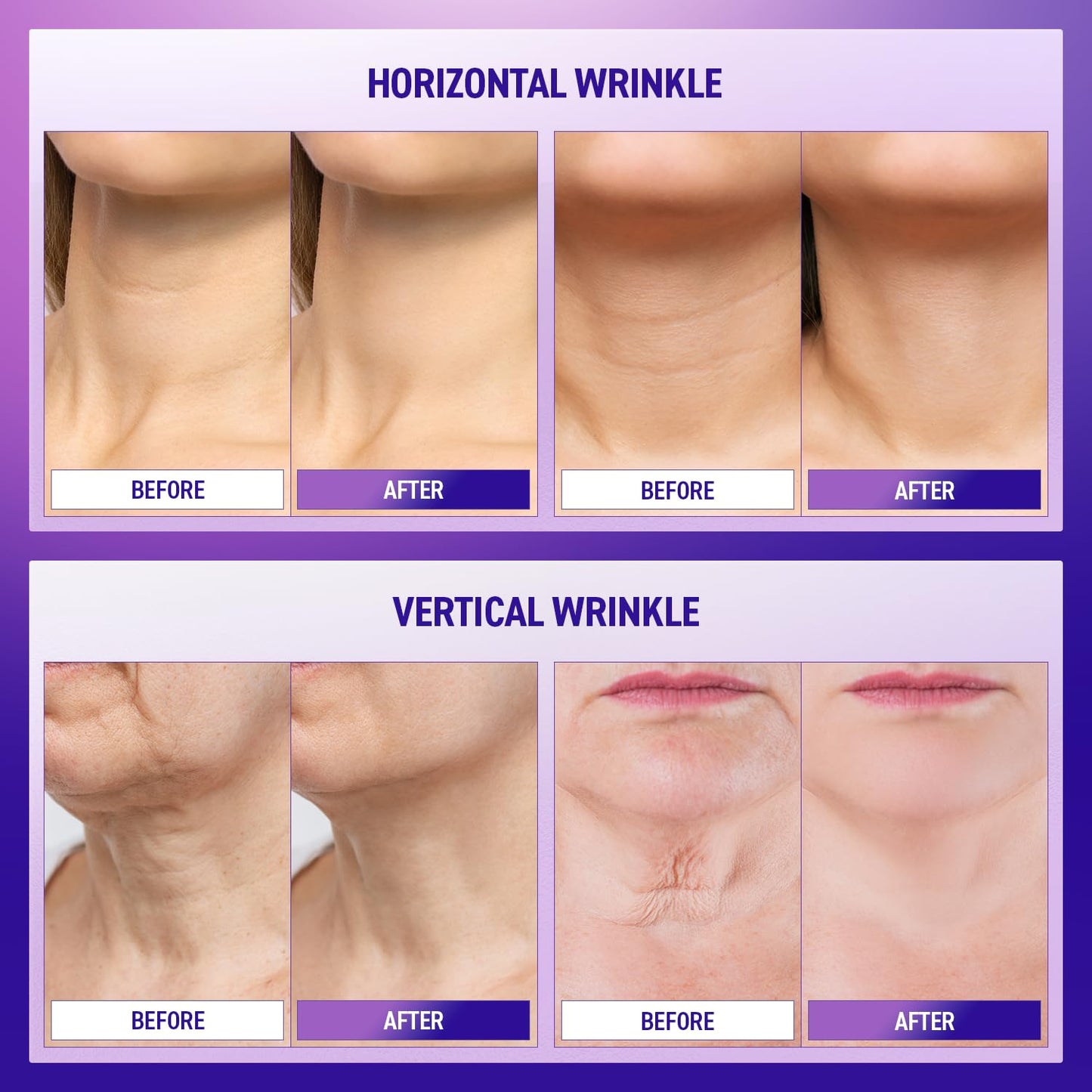 Ashania Neck Firming Cream : Skin Tightening Cream Moisturizer Face and Neck Lift Tightening with Hyaluronic Acid & Peptide & Adenosine Korean Skin Care & Advanced Formula 1.7 fl oz