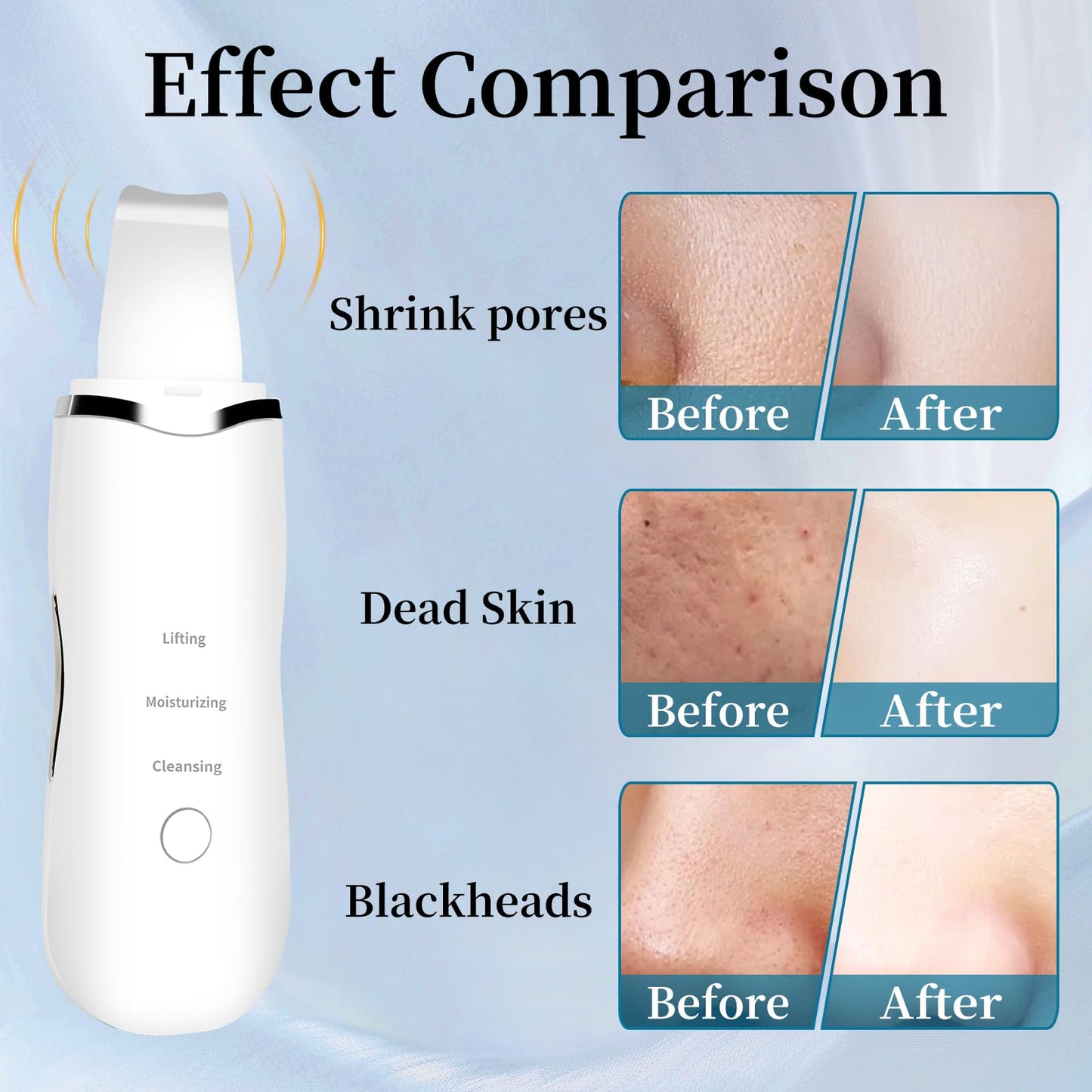 3 Mode Blackhead Remover Tools - Skin Scrubber Face Spatula Blackhead Remover for Deep Cleansing, Waterproof Rechargeable Facial Skincare Device (White)