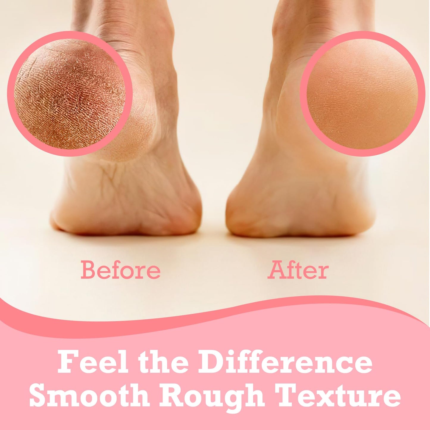 AIFUFAND Crack Feet Prevention Stick Duo (2PC) | Hydrating & Moisturising Heel Balm Stick | Softening and Nourishing Cream for Dry Heels, Hands & Elbows | Plant-Based Gentle Skin Care (Pink & Blue)