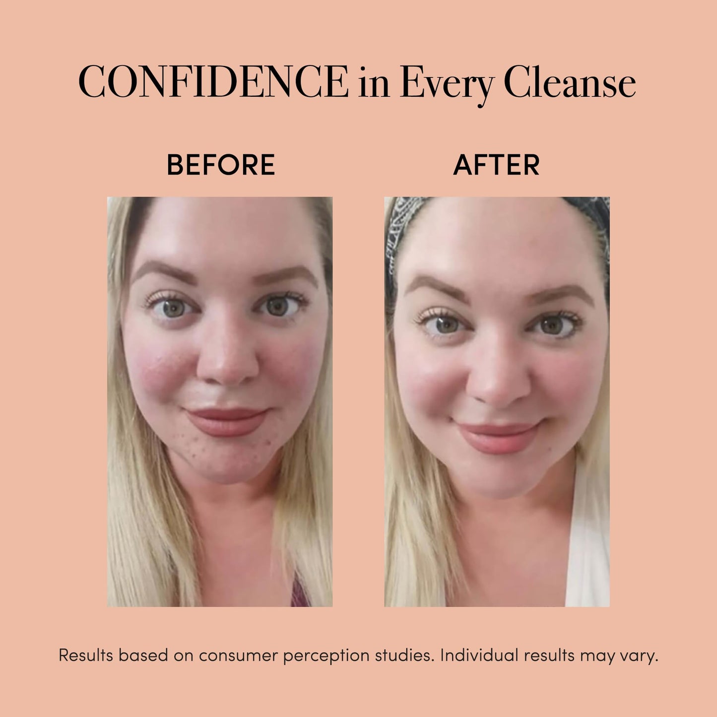 Revive Light Therapy Soniqué Mini Acne Cleanser, Battery-Operated Sonic Face Cleanser Brush with Blue & Red Light Therapy, Medical-Grade Acne Device for Face & Body, Water-Resistant