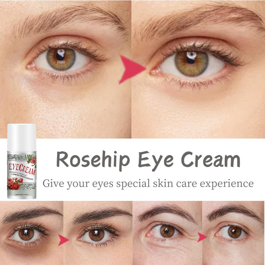 Evolvique Rosehip Under Eye Cream for Dark Circles - Eye Cream Anti Aging - Anti Wrinkle eye cream for Puffiness and Bags Under Eyes - Firming Eye Serum for Women - Best Under Eye Treatment for Bags