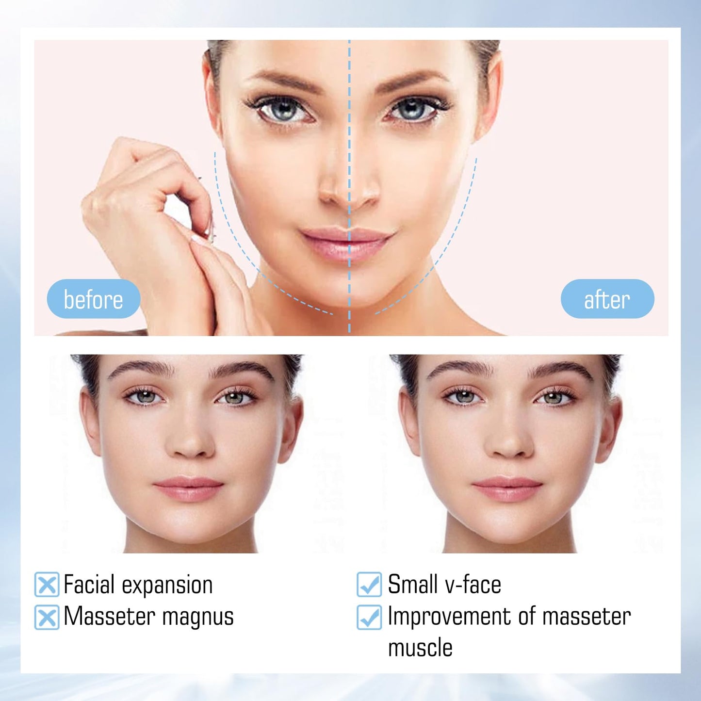 Felico V Line Lifting Mask, 5 Pcs V-Shaped Face Mask, Hydrogel Collagen Mask with Aloe Vera, Neck Tightening Tape Patch Jawline Contour Firming Band, Creating V-shaped Face Full of Vitality